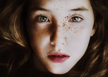 Freckles: A Natural Canvas of Beauty
