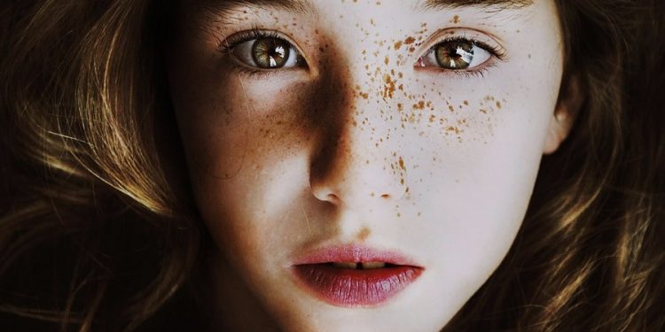 Freckles: A Natural Canvas of Beauty
